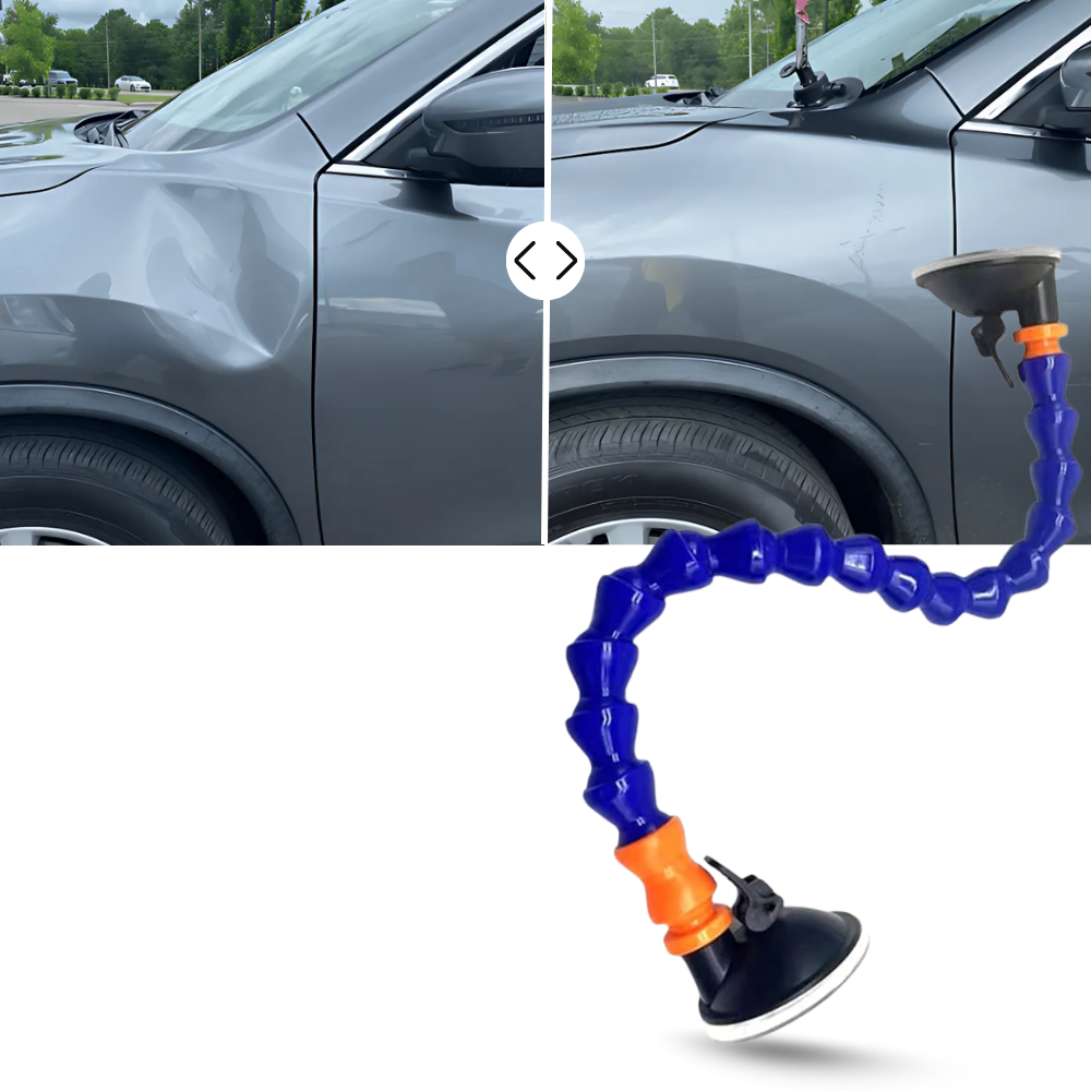 Dent Master Sugkopp  - Ozerty