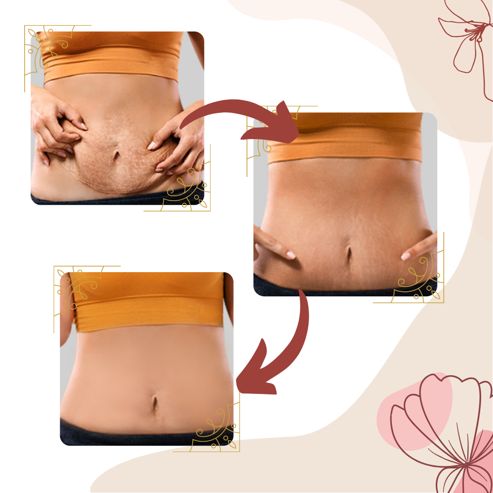 Massageapparat för celluliter med högfrekvent vibration - Ozerty