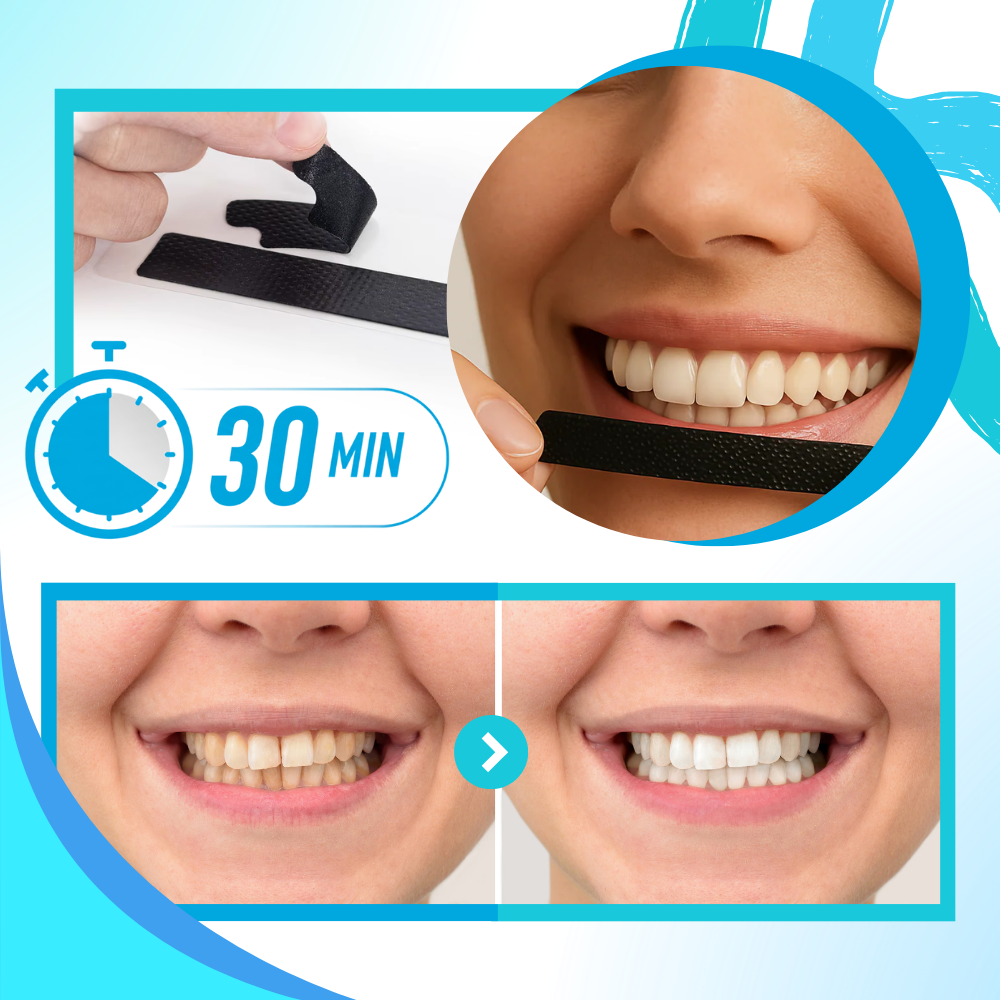 Tandblekningsremsor med kol - Ozerty