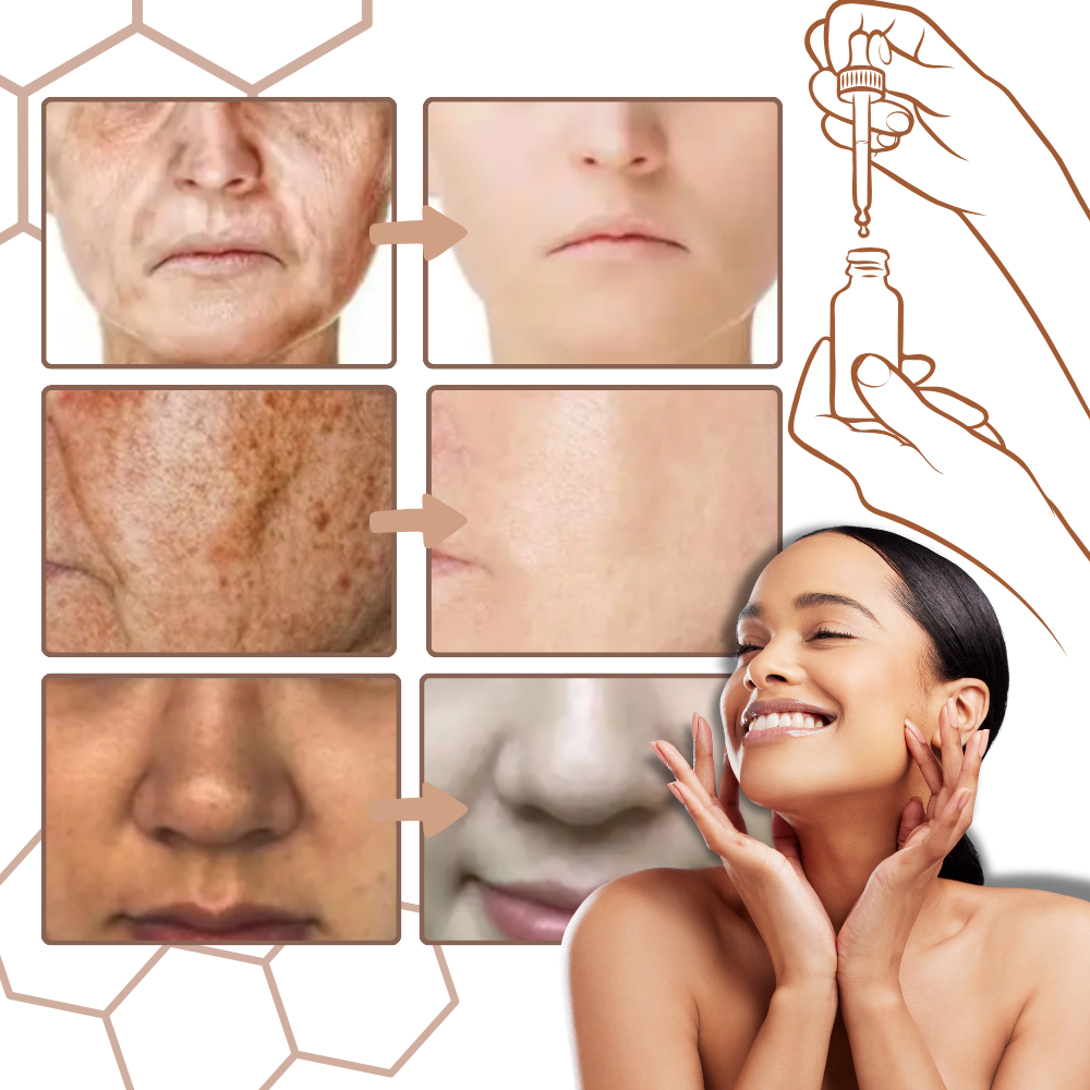 Fettfritt serum för ansiktet med melanin - Ozerty