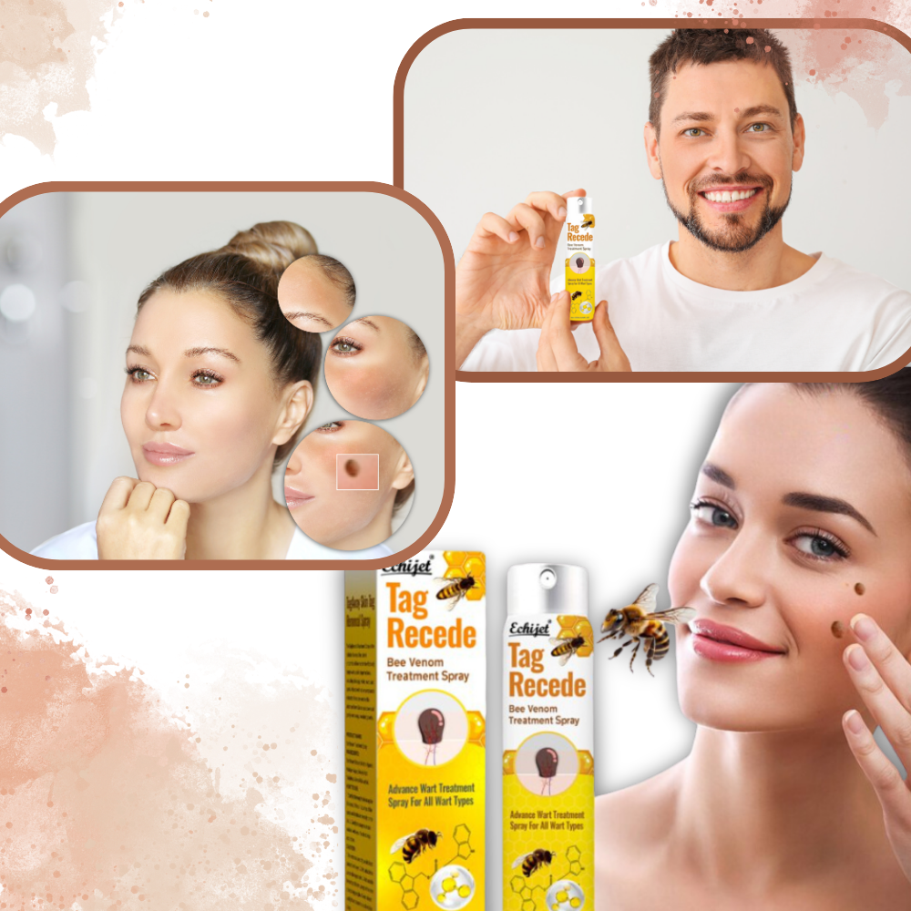 Icke-invasiv behandling för hudflikar och vårtor - Ozerty