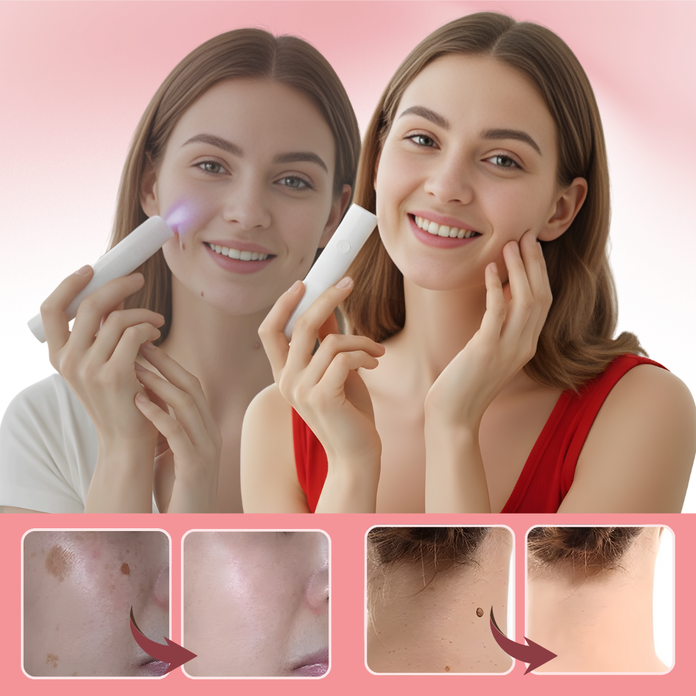 Kosmetisk laserpenna för lyster - Ozerty