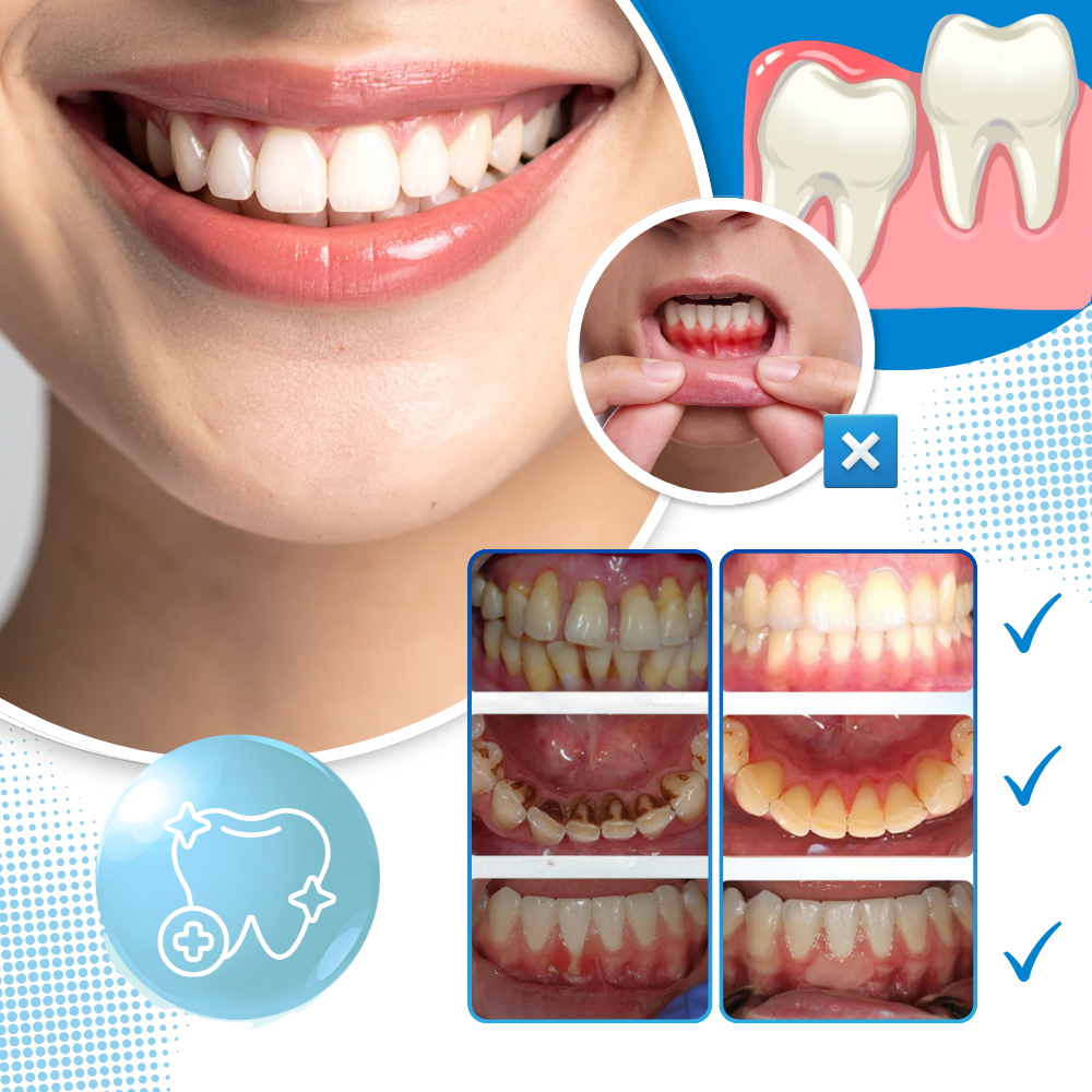 Uppfriskande vita Dental Drops-munvatten - Ozerty