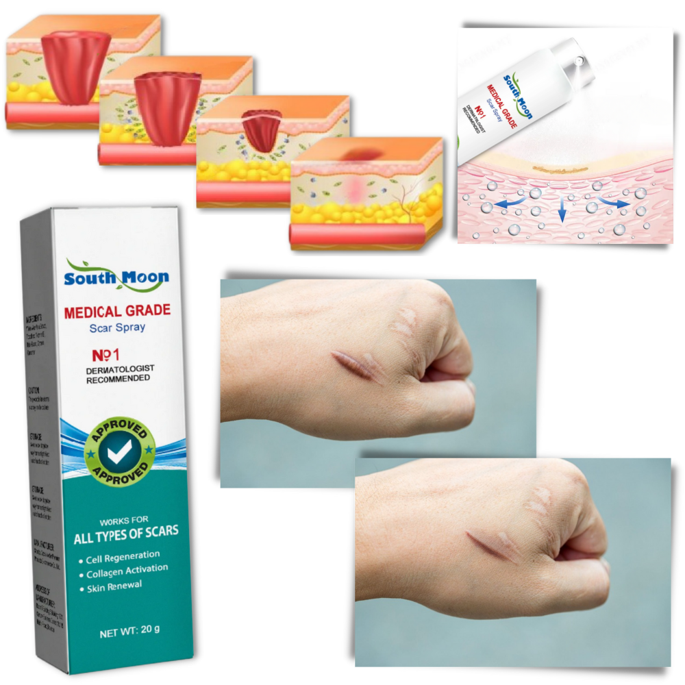 Spray för att ta bort ärr - Ozerty