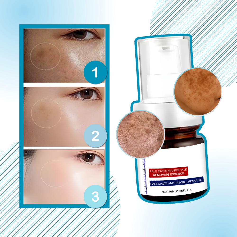 Lystergivande serum med Kojicsyra - Ozerty