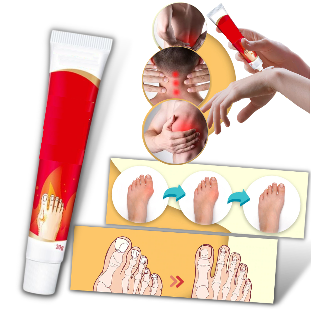 Antiinflammatorisk hallux valgus kräm - Ozerty