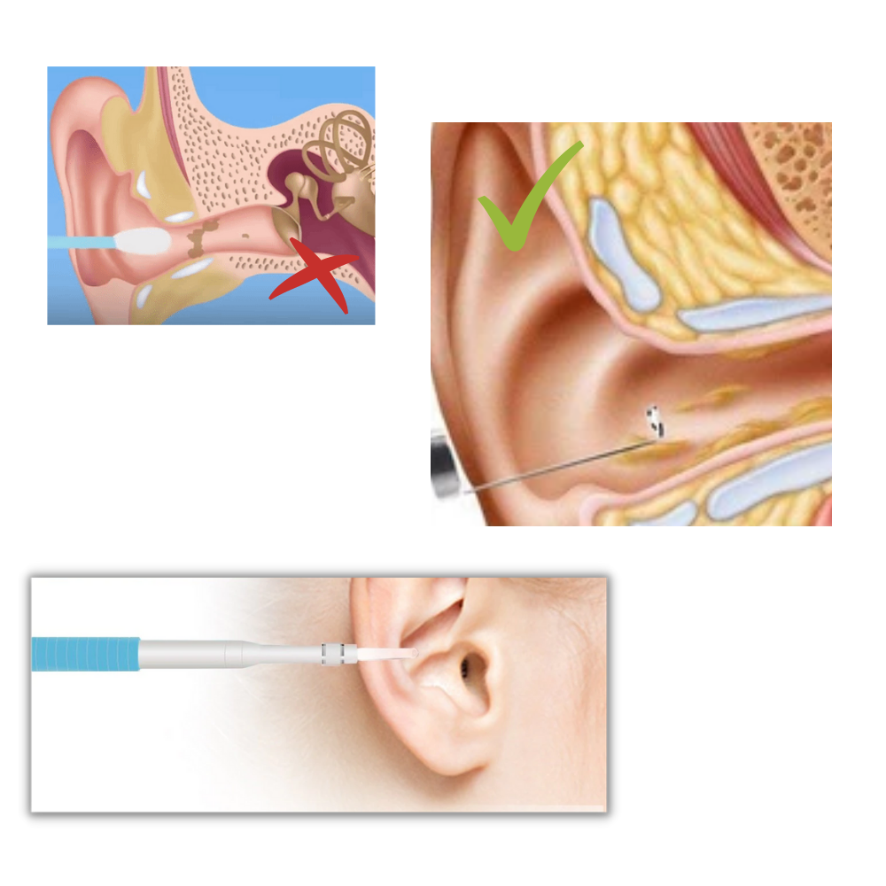 3 i 1 Öronkamera - Ozerty