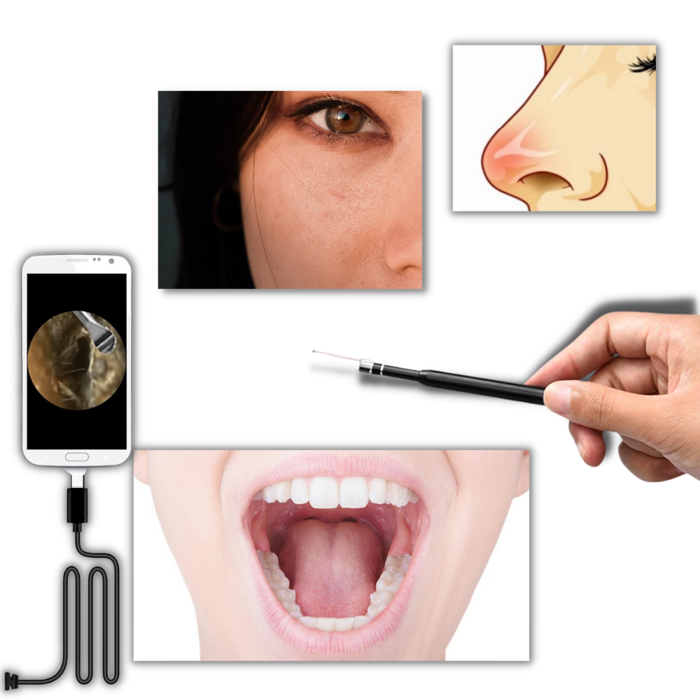 3 i 1 Öronkamera - Ozerty