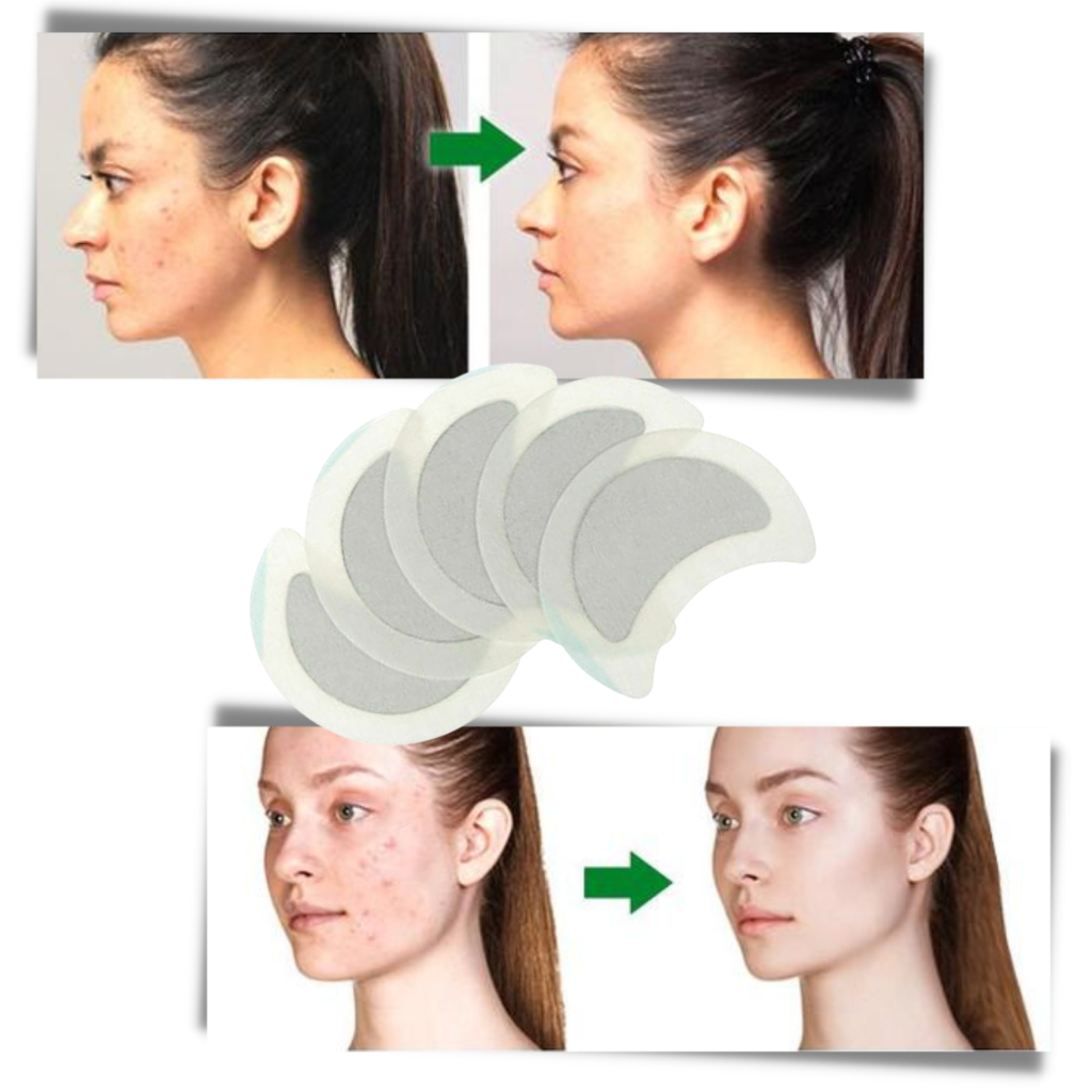 5 x Svettskydd - Ozerty