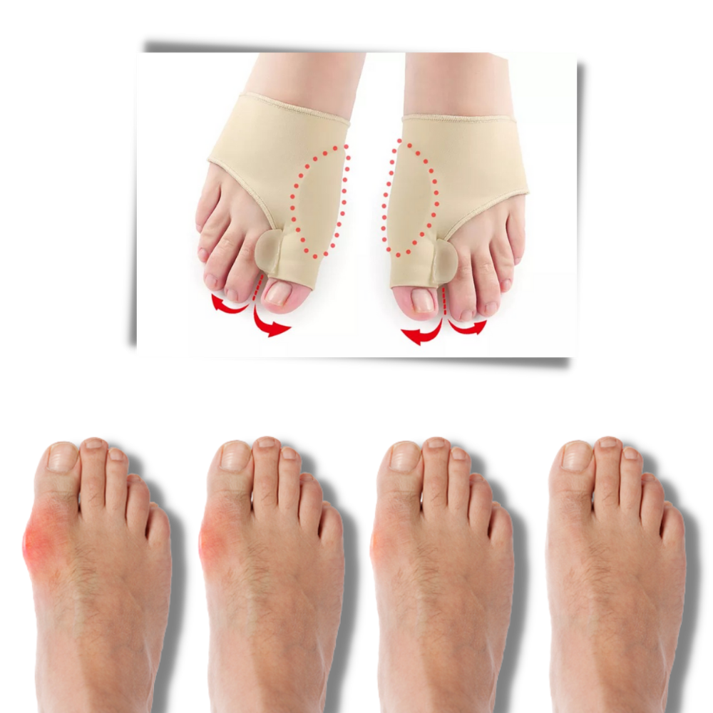 Hallux valgus stöd - Ozerty
