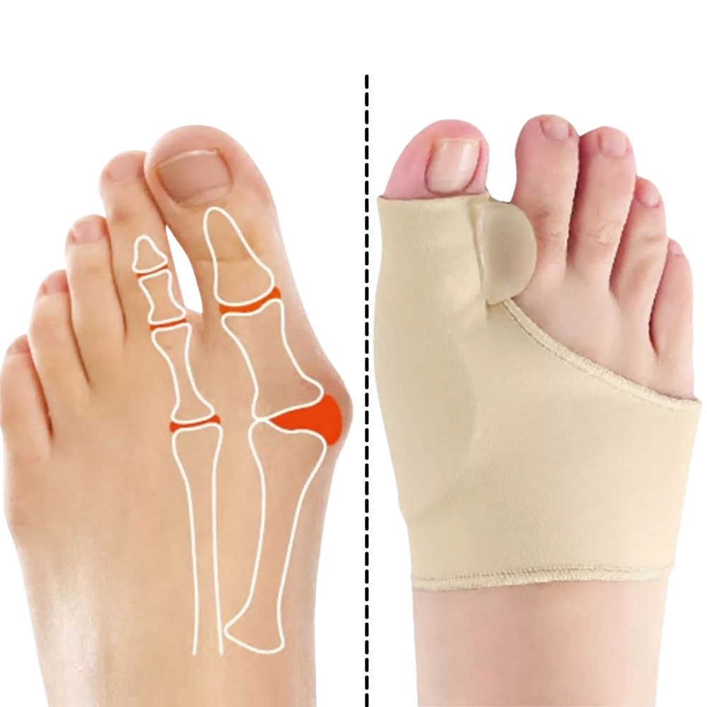 Hallux valgus stöd - Ozerty