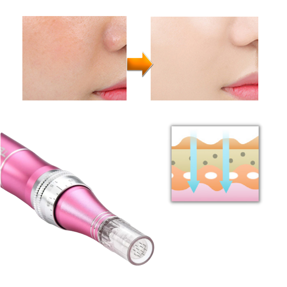 Dermal micro-needling penna - Ozerty