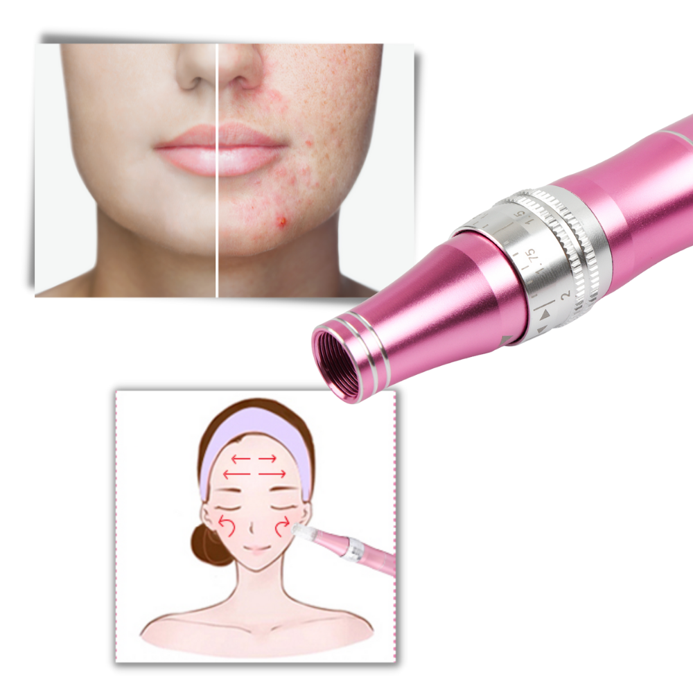 Dermal micro-needling penna - Ozerty