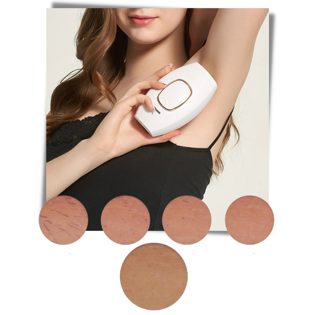 Mini IPL laser hårborttagning - Ozerty