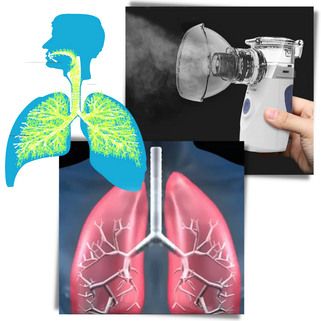Nebulisator med ultraljud - Ozerty