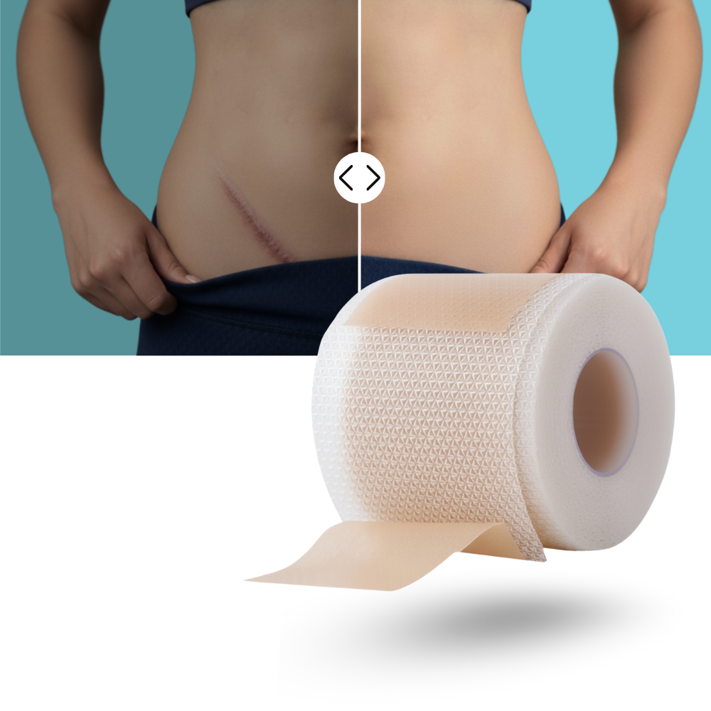 Hyaluroniskt silikonplåster för ärr