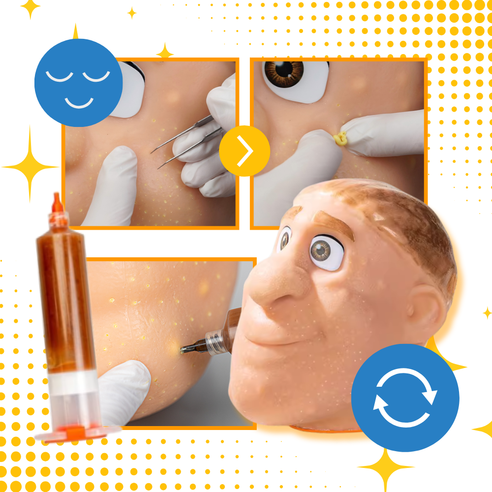 Avslappnande finnklämleksak i silikon - Ozerty