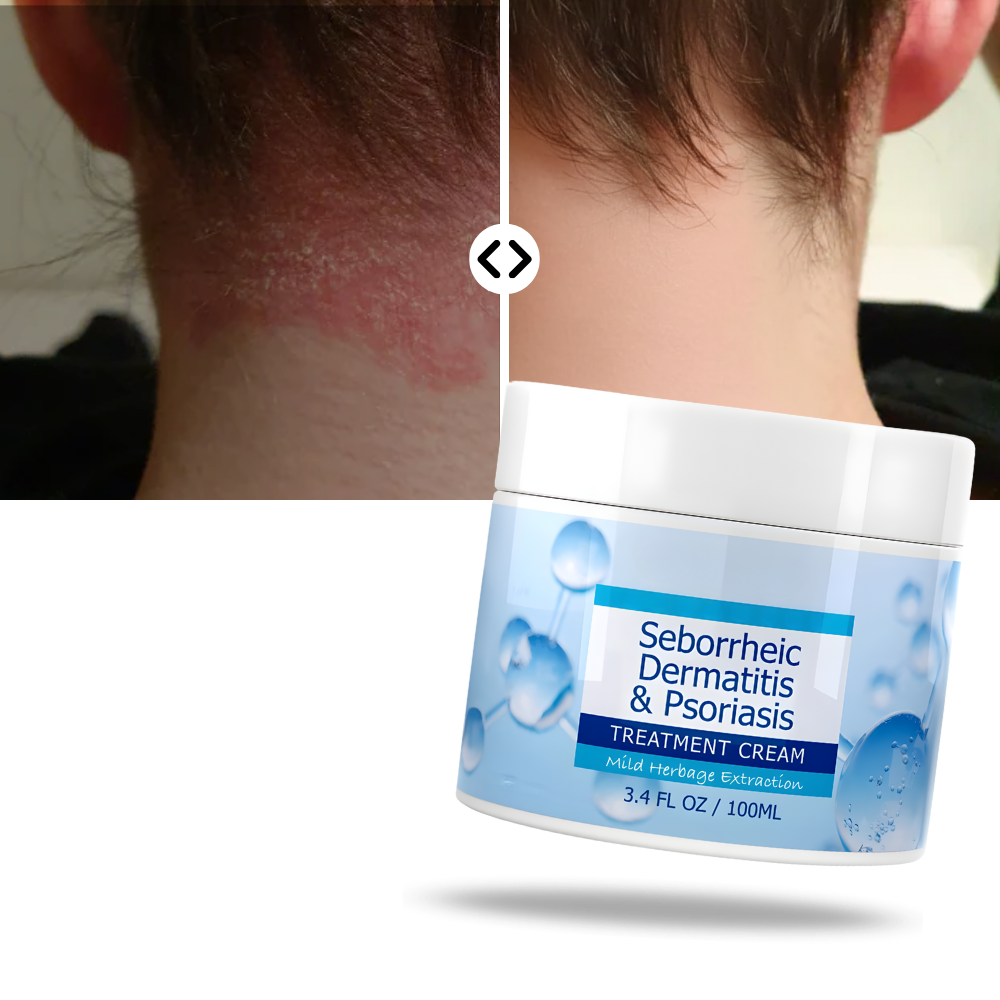 Återfuktande hårbottenkräm - Ozerty