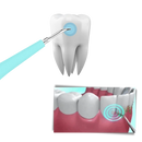 Maskin för djuprengöring av tandsten - Ozerty