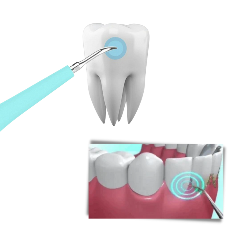 Maskin för djuprengöring av tandsten - Ozerty