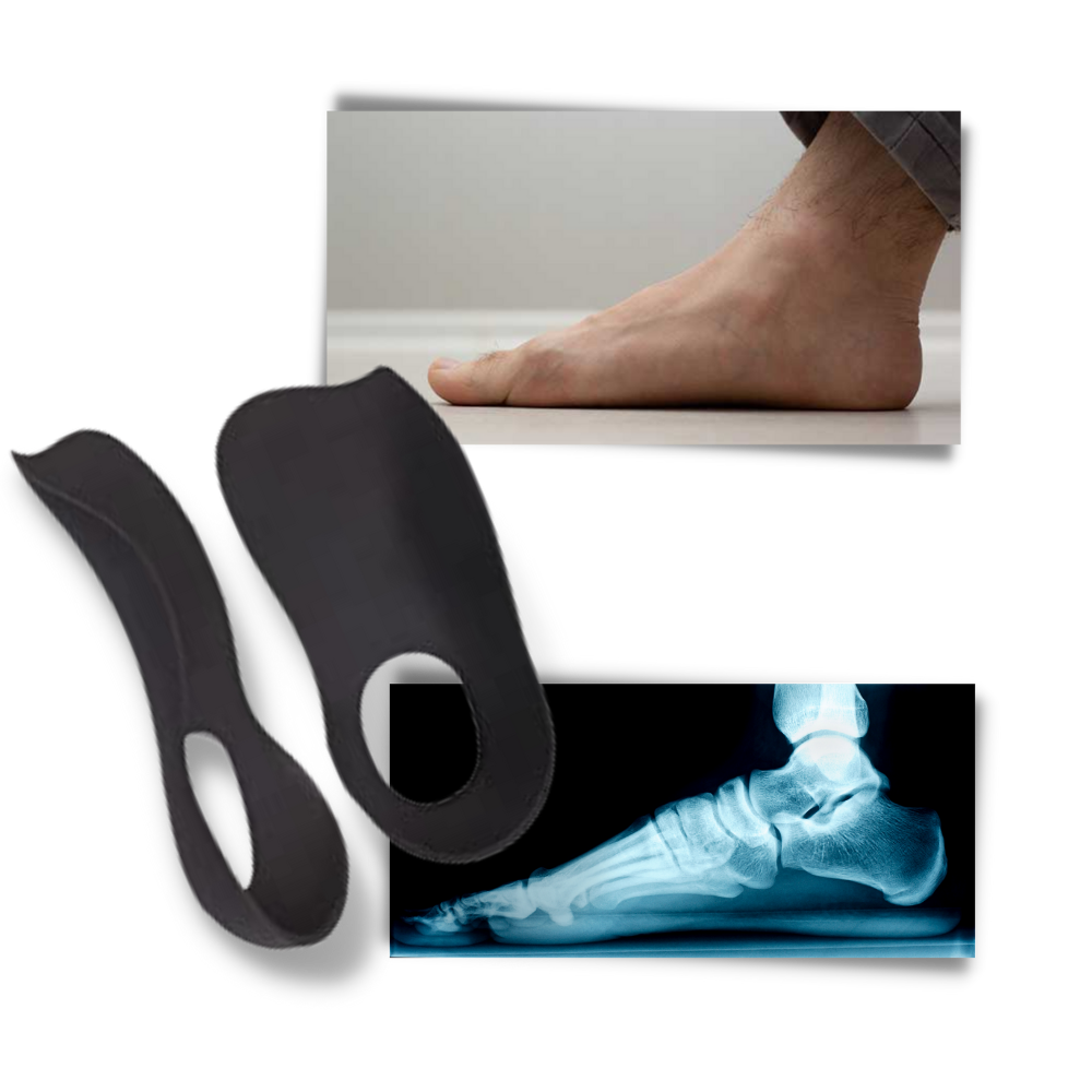 Ortopediska sulor för platta fötter - Ozerty